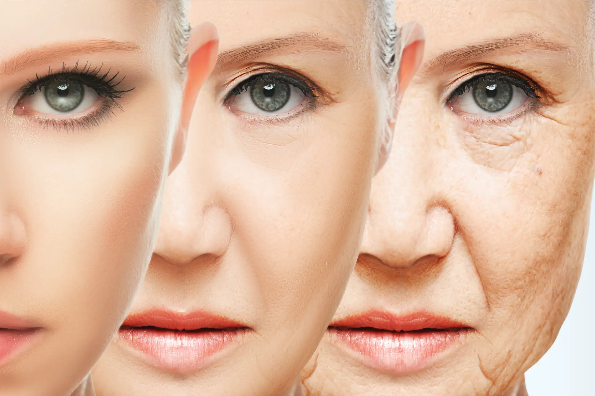 Riduzione delle rughe con il Botox a Milano