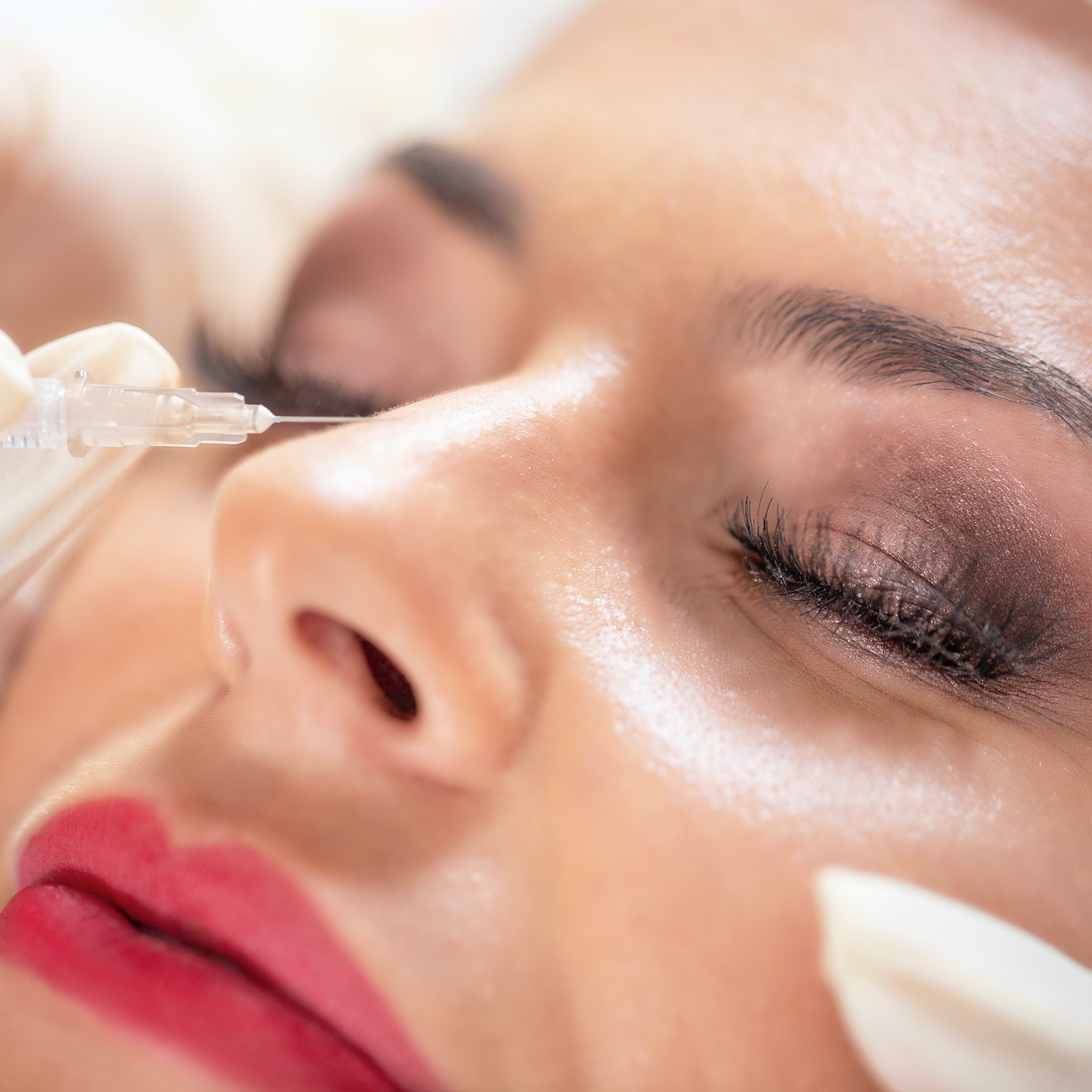 Rinoplastica non chirurgica con Botox Rinoplastica non chirurgica con Botox